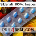 Sildenafil 100Mg Images viagra3